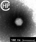 Electron microscopy - adenovirus